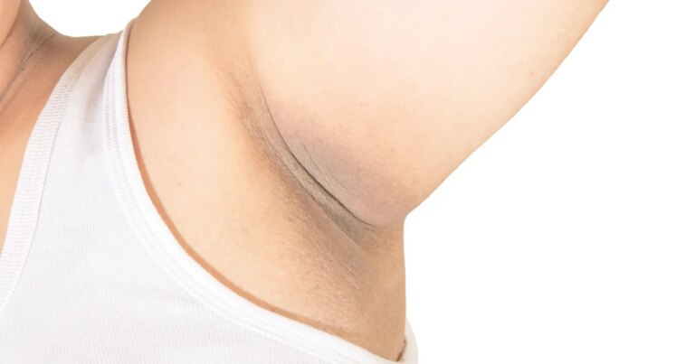 Effectiveness and Safety of Deodorant Concealers: Insights from Dermatologists