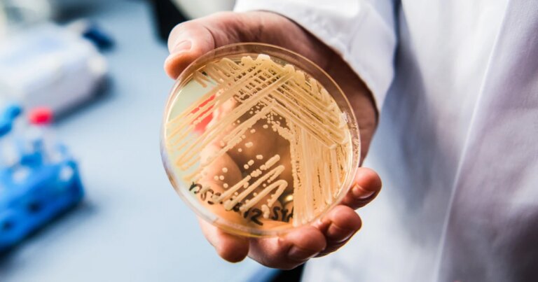 Rising Incidence of Drug-Resistant Candida auris in the United States